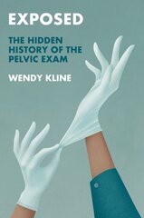 Exposed: The Hidden History of the Pelvic Exam hinta ja tiedot | Historiakirjat | hobbyhall.fi