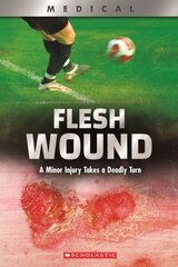 Flesh Wound: A Minor Injury Takes a Deadly Turn (Xbooks): A Minor Injury Takes a Deadly Turn hinta ja tiedot | Nuortenkirjat | hobbyhall.fi