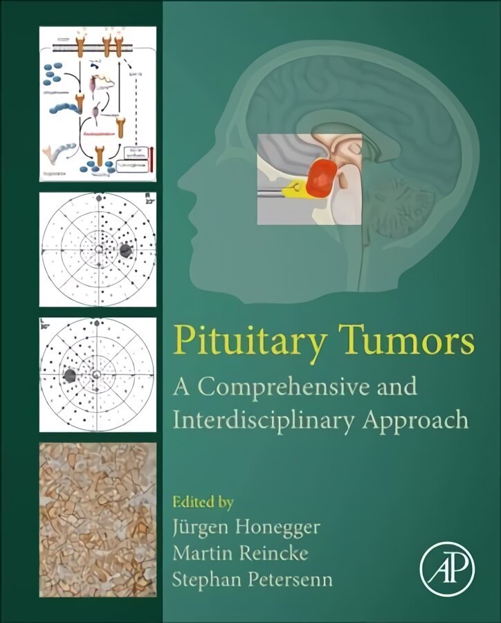 Pituitary Tumors: A Comprehensive and Interdisciplinary Approach hinta ja tiedot | Talouskirjat | hobbyhall.fi