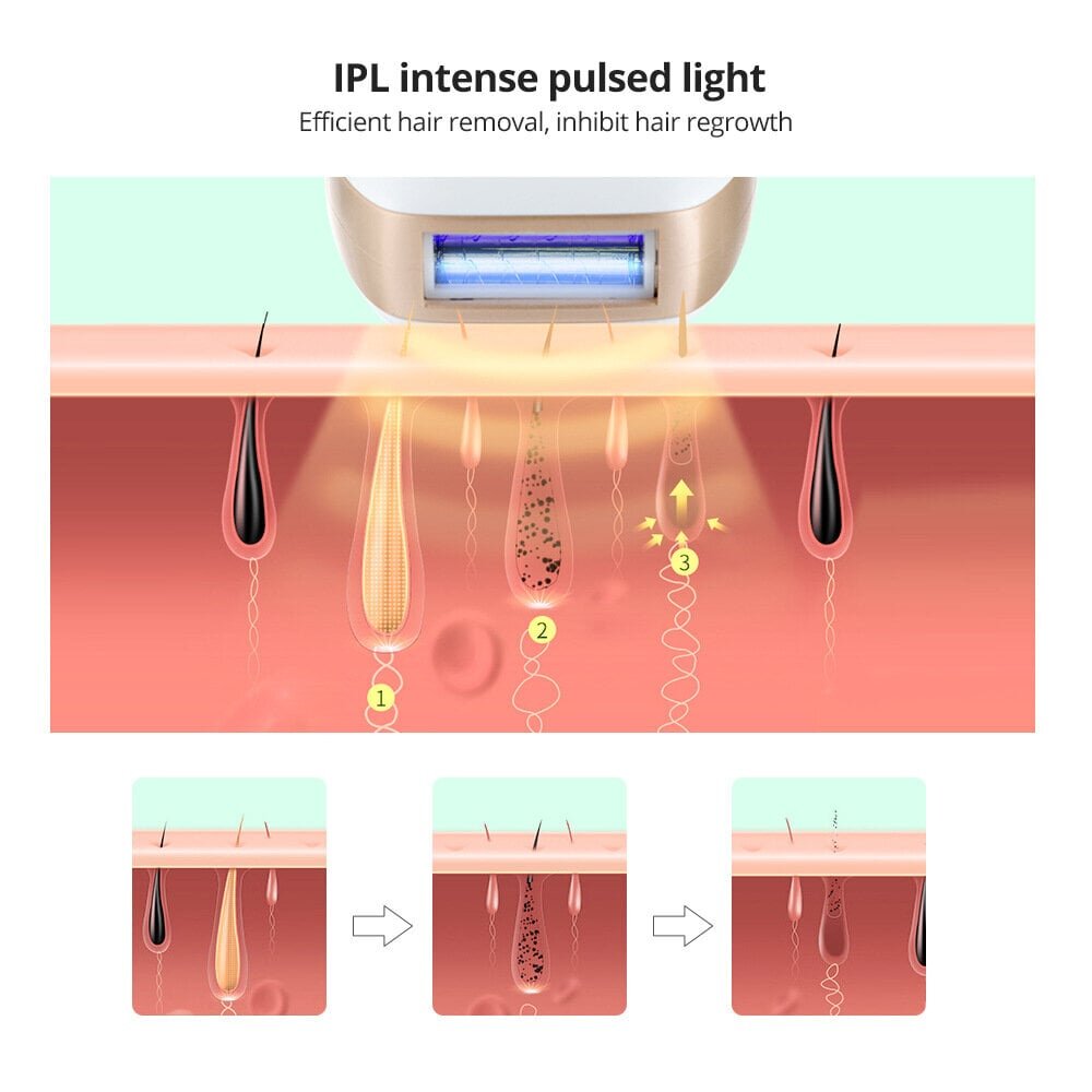 Karvanpoistolaser 999 999 Light Pulse kivuton karvanpoisto, valkoinen hinta ja tiedot | Epilaattorit ja karvanpoistolaitteet | hobbyhall.fi