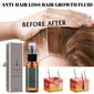 Ginger Hair Growth Serum Spray Herbal Hair Growth Serum Spray hiusten eteerinen öljy hiustenlähtöä estävä ravitseva hiuspäänahkasuihke hinta ja tiedot | Manikyyri- ja pedikyyritarvikkeet | hobbyhall.fi