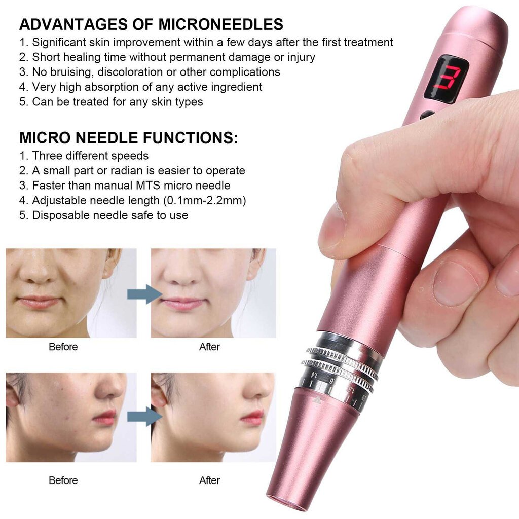 Ammattimainen Derma Pen Micro Needle 3 Gears Adjustment Anti Aging Therapy Skin Device Pink hinta ja tiedot | Kasvojenhoitolaitteet | hobbyhall.fi