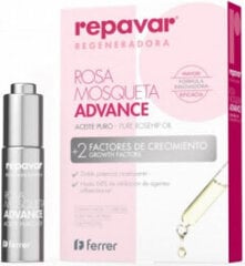 kasvoöljy repavar regenerate pure rosehip oil 15ml hinta ja tiedot | Kasvoöljyt ja seerumit | hobbyhall.fi