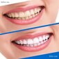 Hampaiden valkaisu nauhat 5D valkaisu 14kpl/7 paria hinta ja tiedot | Suuhygienia | hobbyhall.fi