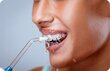 Langaton hammashuuhtelulaite Herz Medical hinta ja tiedot | Hammasvälisuihkut | hobbyhall.fi