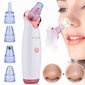 Mustapääimuri 12in1 Diamond microdermabrasion hinta ja tiedot | Kasvojenhoitolaitteet | hobbyhall.fi